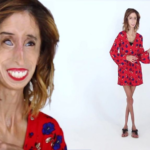 Lizzie-velasquez anti bullying